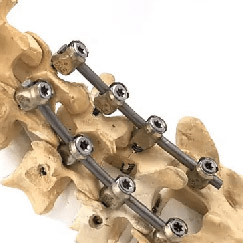 Spinal systems