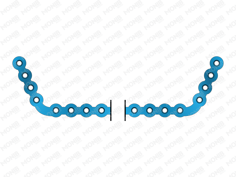 Full Mandibular Reconstruction Plate System